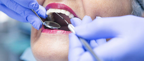 Best Dental Abscess Treatment in Oracle, AZ